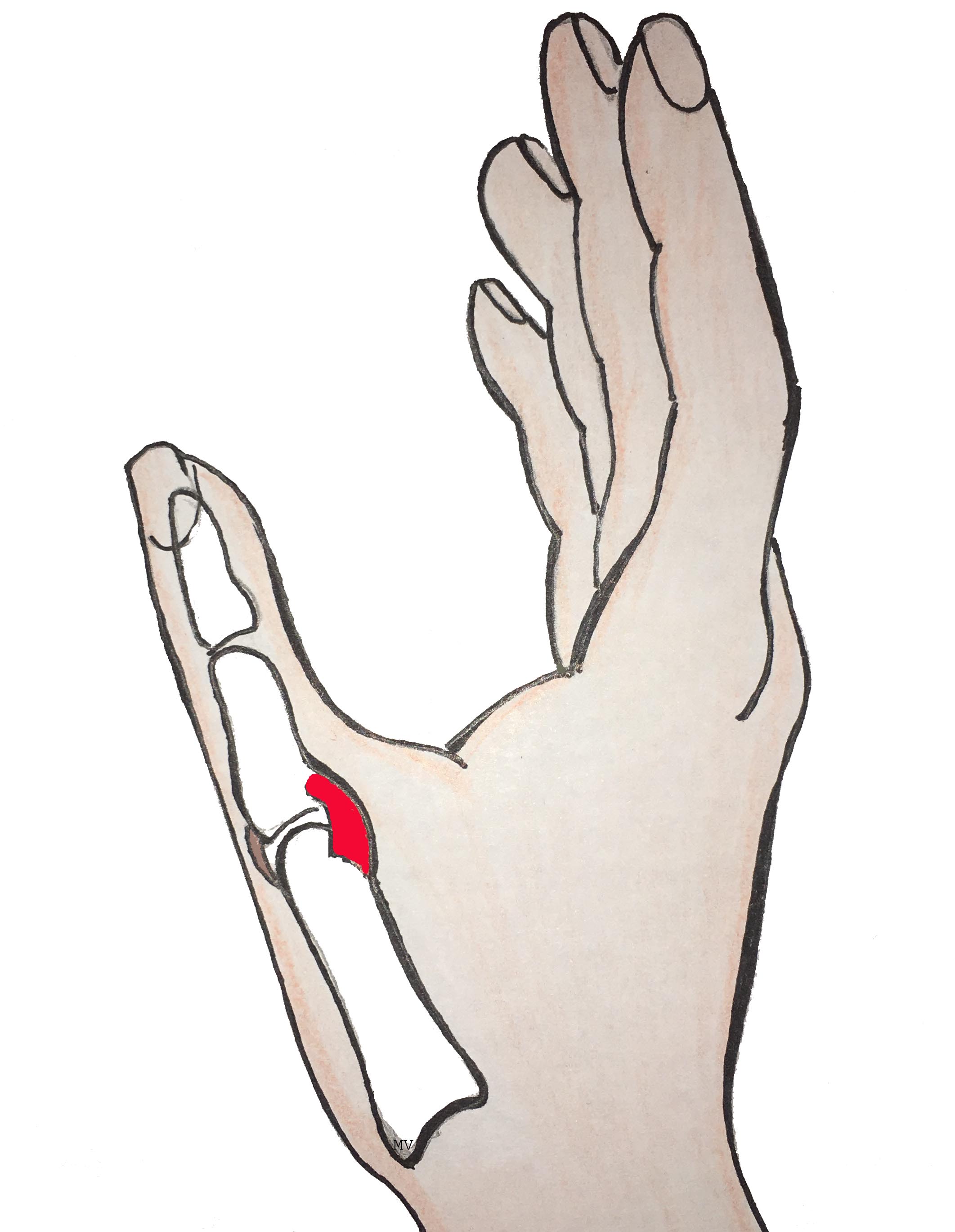 Ligament latéral interne du pouce (en rouge)